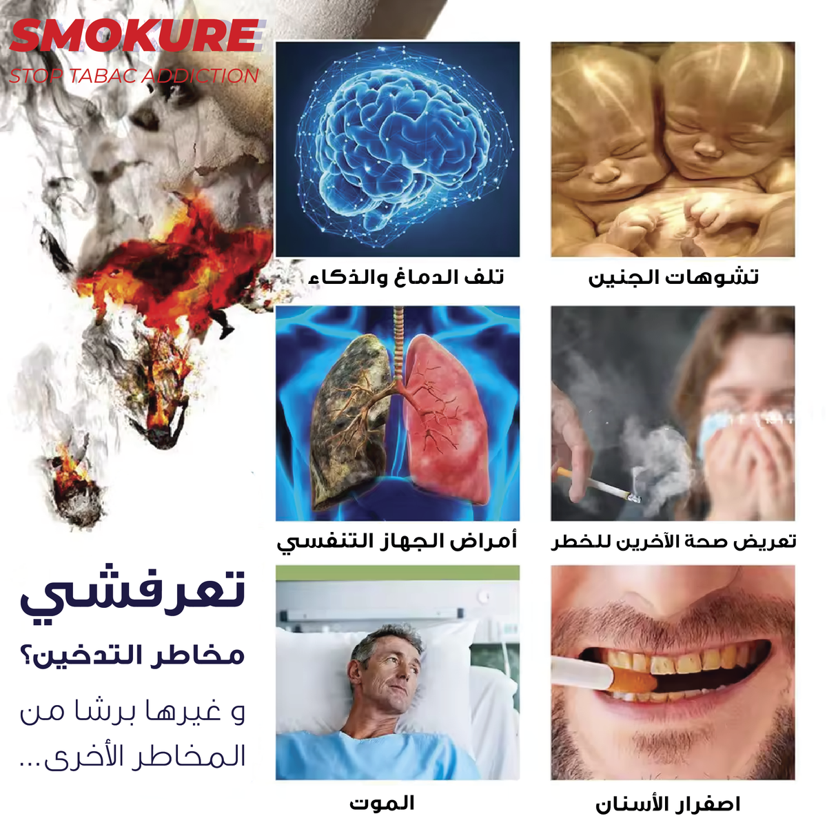 SMOKURE Stop Tabac Addiction